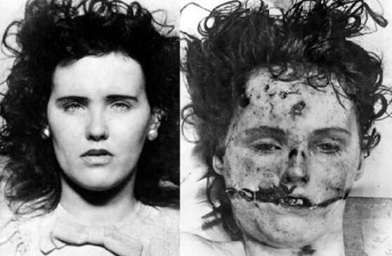 黑色大丽花惨案现场图片：伊丽莎白·安·肖特尸体子宫被摘除