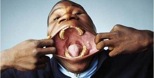 世界上嘴巴最大的人 最大嘴巴宽19.5厘米(破吉尼斯纪录)