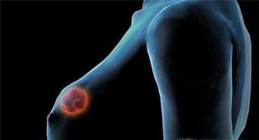 乳房有肿块是什么原因？该如何消除乳房肿块？