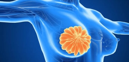 乳腺癌是怎么引起的？乳房癌症的十大早期信号