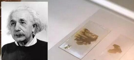 爱因斯坦的大脑死后被偷走 切片研究其中的奥秘