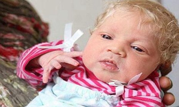 为什么？黑人父母会生出纯白宝宝？不明基因突变金发蓝眼